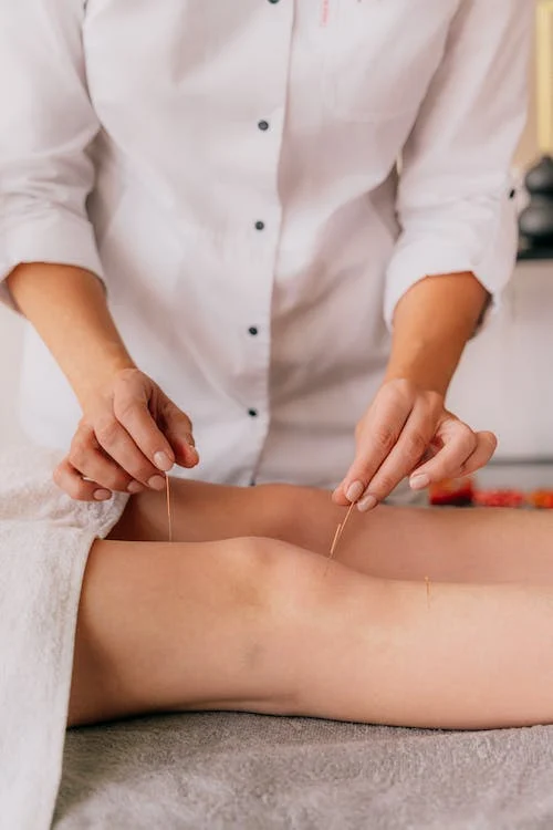 An acupuncturist inserts very thin steel needles into skin of a patient.