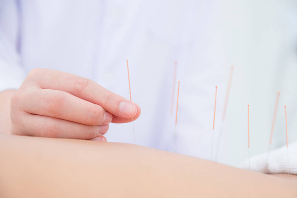 acupuncture in kent - joint injection clinic