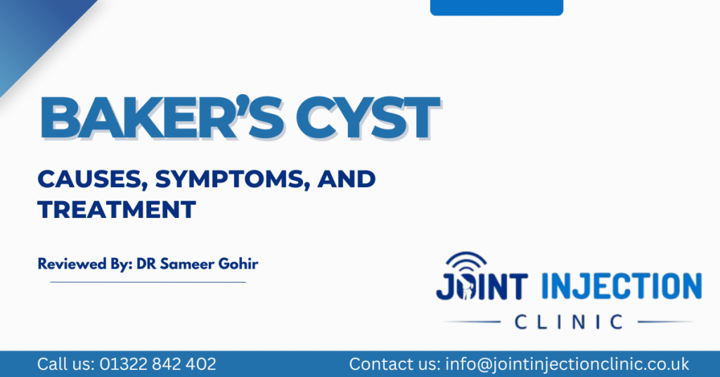 Baker's Cyst
