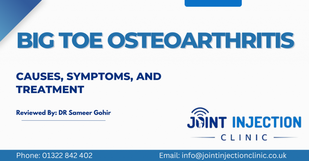 Big Toe Osteoarthritis